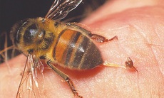 Ong đốt có thể gây nguy hiểm cho trẻ
