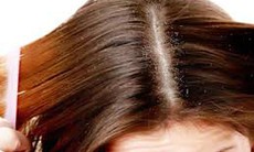Da đầu ngứa, nhiều gàu phải trị cách nào?