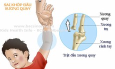 Kéo tay đột ngột, coi chừng trật khuỷu tay ở trẻ