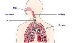 Viêm phế quản cấp ở người lớn