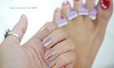 Bao lâu thì móng tổn thương mọc trở lại?