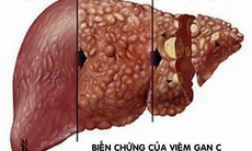 Thuốc mới điều trị viêm gan C