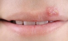 10 dấu hiệu bệnh tật chớ bỏ qua