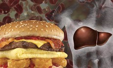 Cholesterol giúp bạn khỏe mạnh