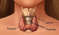 Các phương pháp điều trị bướu cổ bằng phẫu thuật