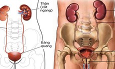 Phòng ngừa bệnh thận như thế nào?