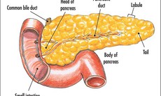 Khối u lành tính ở tuyến tuỵ