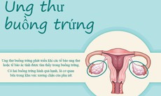 Tiến trình ung thư buồng trứng cướp sinh mạng phụ nữ