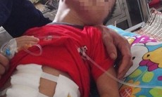Bé trai 5 tuổi bị đánh vỡ gan, gãy xương sườn