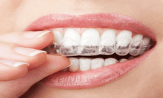 Tật nghiến răng và hậu quả nặng nề
