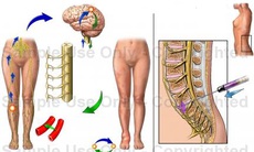 Ðau loạn dưỡng do thần kinh giao cảm