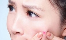 Làm gì khi bị mụn nhọt?