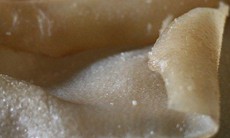 Ăn da động vật: Thủng ruột vì lông!