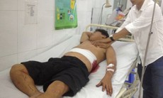 Người cha bị chém trong đêm vì con gái có người yêu khác