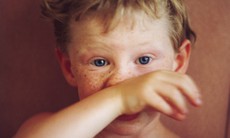 21 bệnh trẻ em mà các bậc cha mẹ nên biết