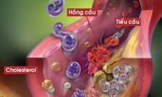 Bệnh nhân rối loạn đông máu vẫn có được cuộc sống bình thường