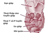 Thuốc trị bệnh cường giáp