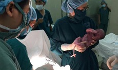 Bộ trưởng Bộ Y tế biểu dương các bác sĩ liên viện cứu sống trẻ sơ sinh 1 ngày tuổi