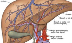 Gan đang nhiễm độc nếu có dấu hiệu sau