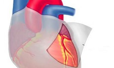 Có thể tái sinh tế bào cơ tim