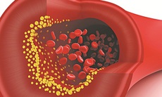 Đi bộ có lợi cho bệnh tim mạch