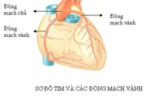 Các yếu tố nguy cơ của bệnh động mạch vành
