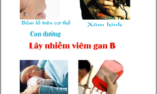 Bệnh gan do nghề nghiệp