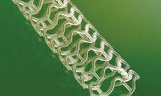 Giá đỡ tự tiêu tăng tỉ lệ thành công trong can thiệp động mạch vành
