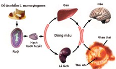 Khuẩn trên táo Mỹ gây bệnh nguy hiểm thế nào?