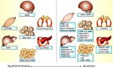 Hội chứng chuyển hóa và nguy biến khôn lường