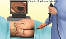 Dấu hiệu bị polyp đại tràng