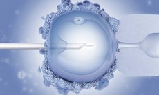 Tiêm tinh trùng vào bào tương noãn: Kỹ thuật chữa vô sinh an toàn