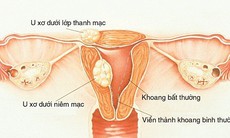 Sảy thai tự nhiên ở tam cá nguyệt I: Những nguyên nhân và giải pháp