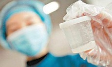 Làm đẹp bằng “sữa đàn ông”?