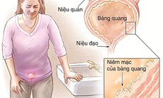 Tại sao bàng quang dễ viêm?