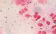 Chlamydia gây bệnh mắt hột