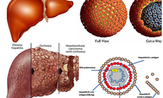 Nguy cơ ung thư gan cao do không đánh giá đúng trạng thái người mang vi rút
