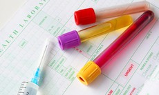 Xét nghiệm công thức máu