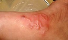 Mù mắt, sảy thai vì nuôi thú cưng