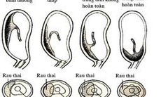 Rau tiền đạo có nguy hiểm?