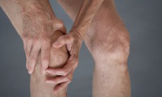 Bổ sung calci ở người lớn tuổi bị thoái hóa khớp