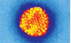 Viêm não do virut herpes âm thầm mà nguy hiểm