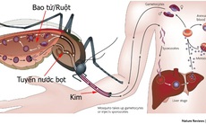 Một bệnh nhi sốc sốt xuất huyết biến chứng xuất huyết nặng được cứu sống