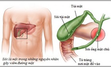 Nhận biết nhiễm khuẩn đường mật
