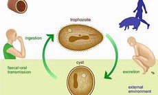 Trùng lông Balantidium có thể gây thủng ruột