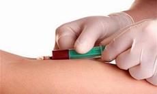 Thử máu chẩn đoán ung thư vú giai đoạn sớm