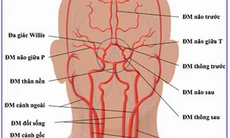 Hẹp động mạch cảnh, nguy hiểm thế nào?