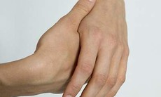 Tê tay có thể là dấu hiệu bệnh 