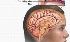 Bệnh viêm màng não mô cầu có phòng được không?