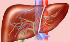 Thuốc giảm cholesterol có lợi cho bệnh nhân ung thư gan